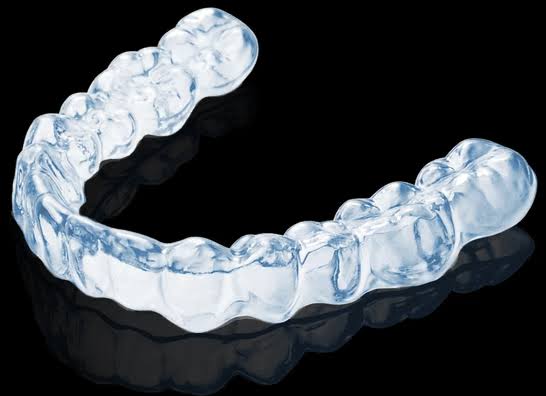 Stepwise Choices: How I Picked Invisible Braces That Actually Worked